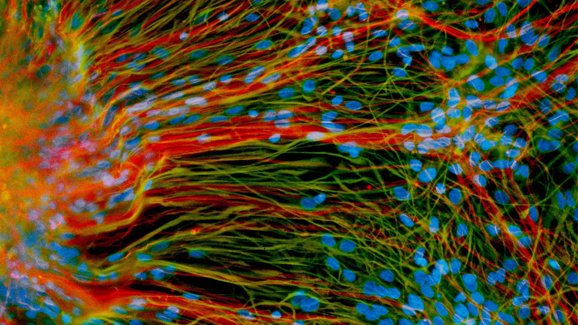 Mature neurons (red) and glial cells (green) in a lab dish, derived from human embryonic stem cells. Taken from Zhang’s lab, UW-Madison.