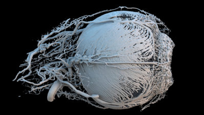 Imatge dels vasos sanguinis d'un ull de porc, generats per impressió 3D.
