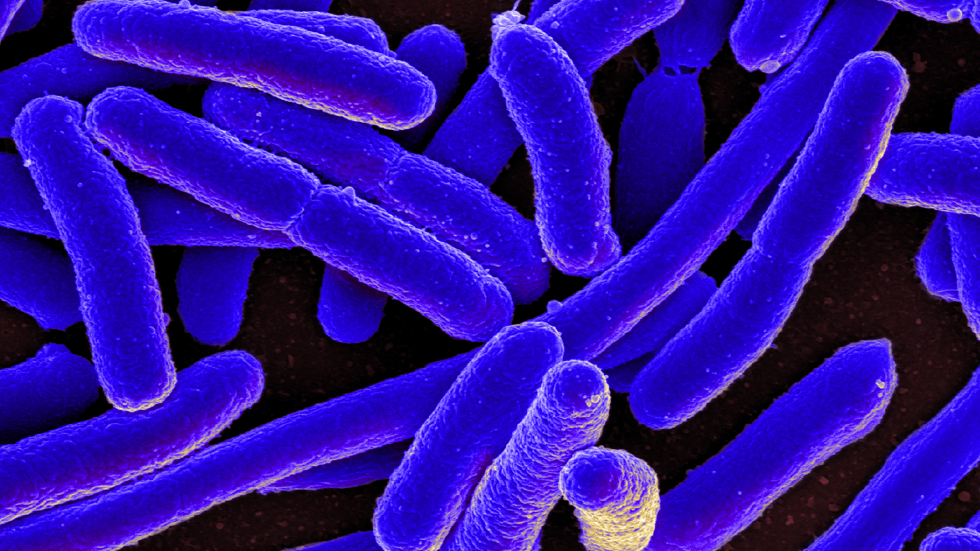 Escherichia coli is one of the bacteria that form our microbiota, along with Candida albicans and Staphylococcus aureus.