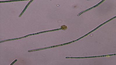 Nuclearia thermophila feeding on cyanobacteria.