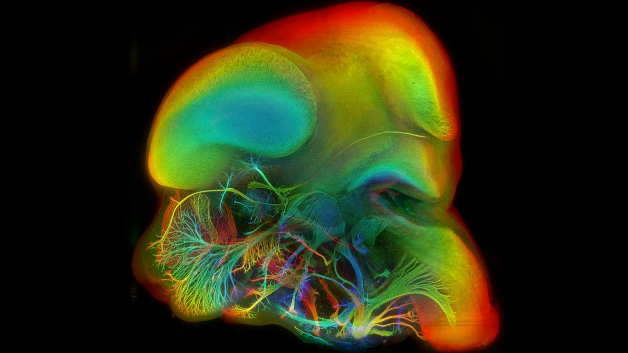 Visualització del teixit precursor neuronal, tractat químicament per fer-lo òpticament transparent i escanejat mitjançant un microscopi d'il·luminació de pla selectiu (SPIM). Imatge de Comal, Mayer i Swoger (CRG)