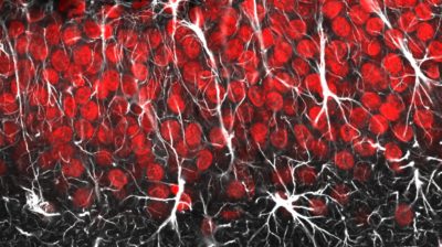 Astrocytes and radial glia by Jason Snyder, CC BY 2.0