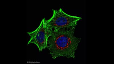 Fluorescence microscopy image, taken by Julia Von Blume, CRG