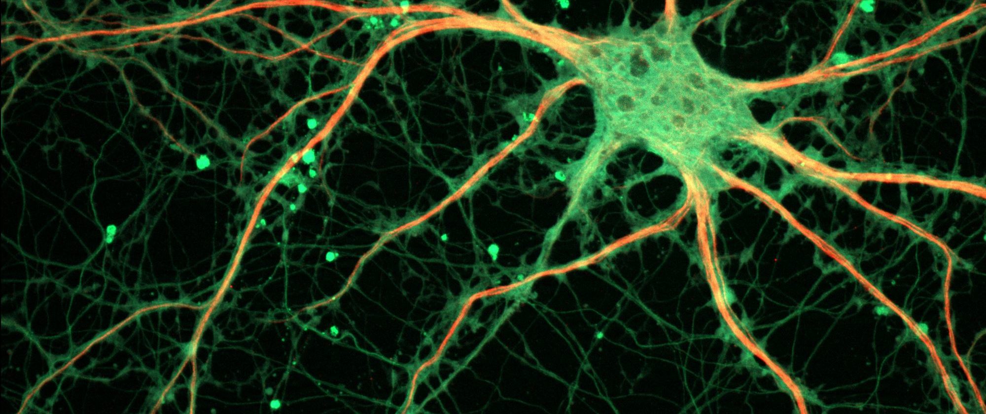 Los canales iónicos juegan un papel esencial en las sinapsis. Sin estos canales, el sistema nervioso no sería capaz de enviar ni recibir señales (Imagen de ZEISS Microscopy en Wikipedia).