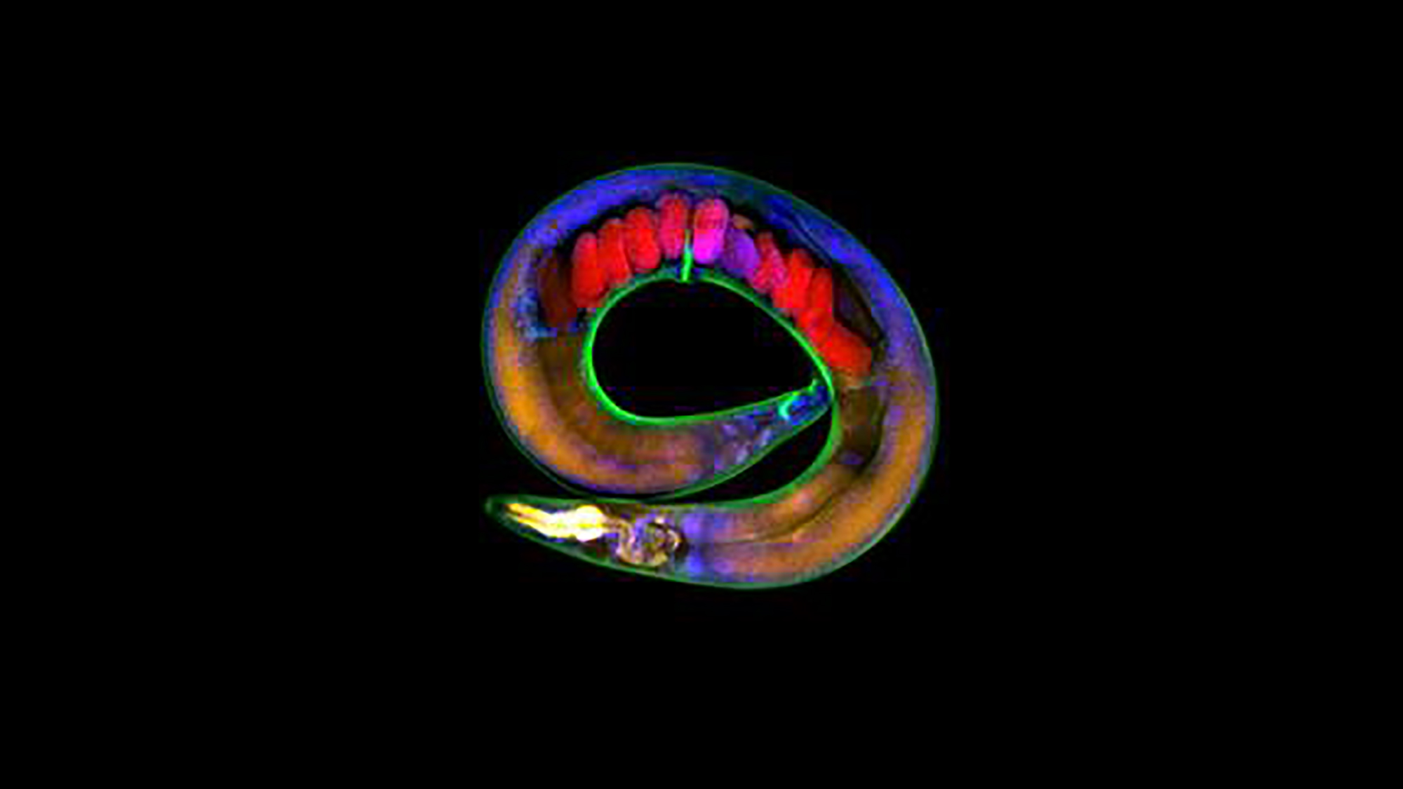 C.elegans es un gusano de 1 mm que comparte el 35% de los genes con los humanos y se usa ampliamente en la investigación como sistema modelo. Foto de Adam Klosin, CRG.