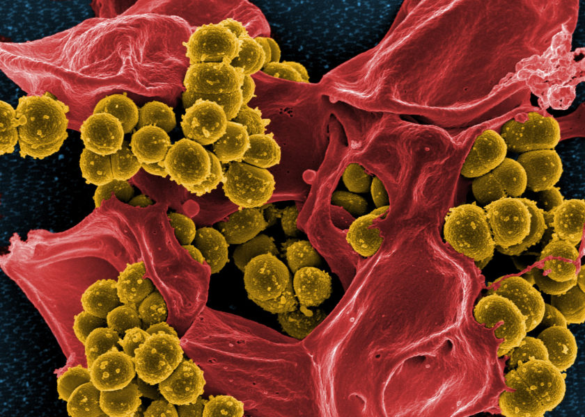  Scanning electron micrograph of methicillin-resistant Staphylococcus aureus and a dead human neutrophil. Credit NIAID