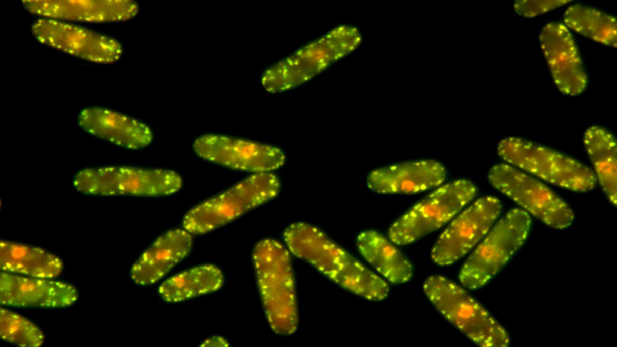 Agregados de proteínas que aparecen en células de levadura Schizosaccharomyces pombe expuestas a elevadas temperaturas. | Imagen de Margarita Cabrera.