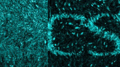 Van utilitzar la llum per marcar un patró de lletres a una àrea més petita que el gruix d’un cabell al biofilm, format per centenars de bacteris. | Imatge de la UPF i UCSD.