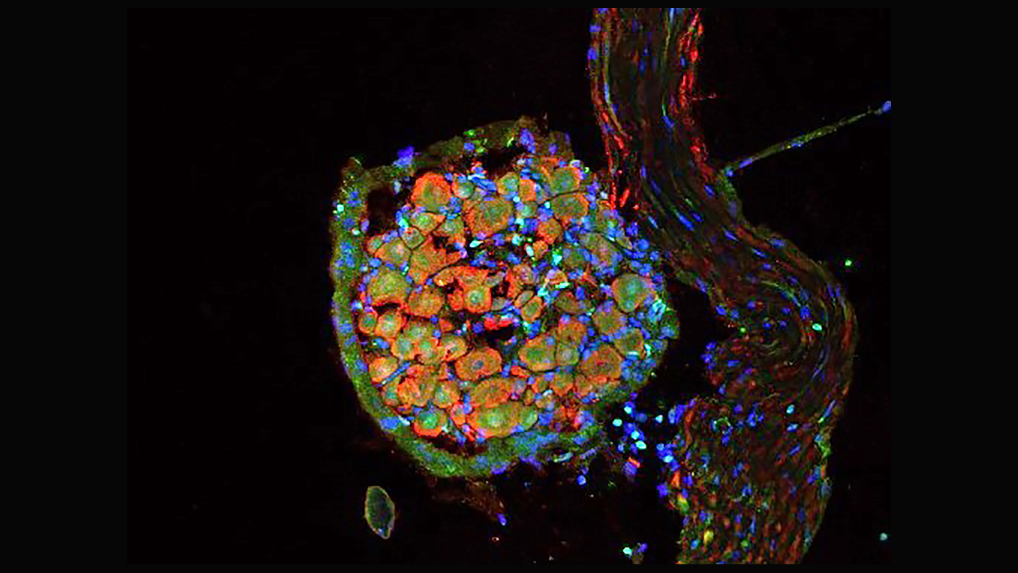 Cèl·lules immunes marcades amb una proteïna fluorescent verda que indica la presencia del receptor cannabinoide tipus 2 (CB2) infiltren el nervi lesionat d’un ratolí. Imatge de l'article DOI: 10.7554/eLife.55582.