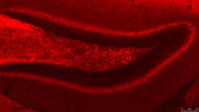 La proteïna quinasa C s'expressa en l'hipocamp de ratolí. La seva falta, fa fallar la memòria a curt termini. Imatge de la UPF.
