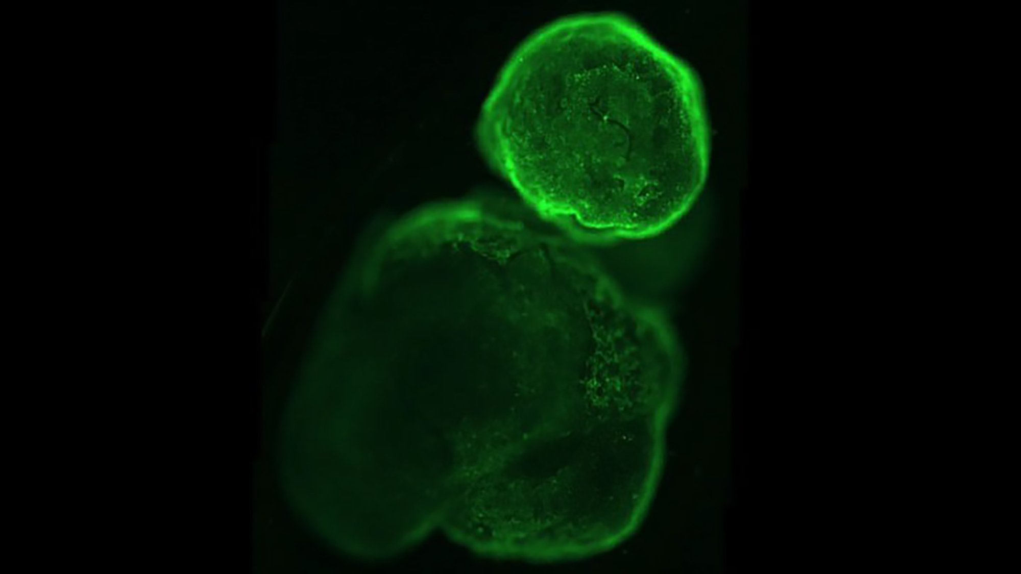Organoid images will be key to studying the effect of infection. Image by Sandra Acosta, IBE.