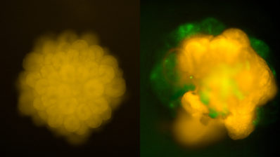 Image of two "mini brains". The one on the left is younger and is plw of orange lobes and the one on the right is more mature, has an amorphous shape and is orange and green.