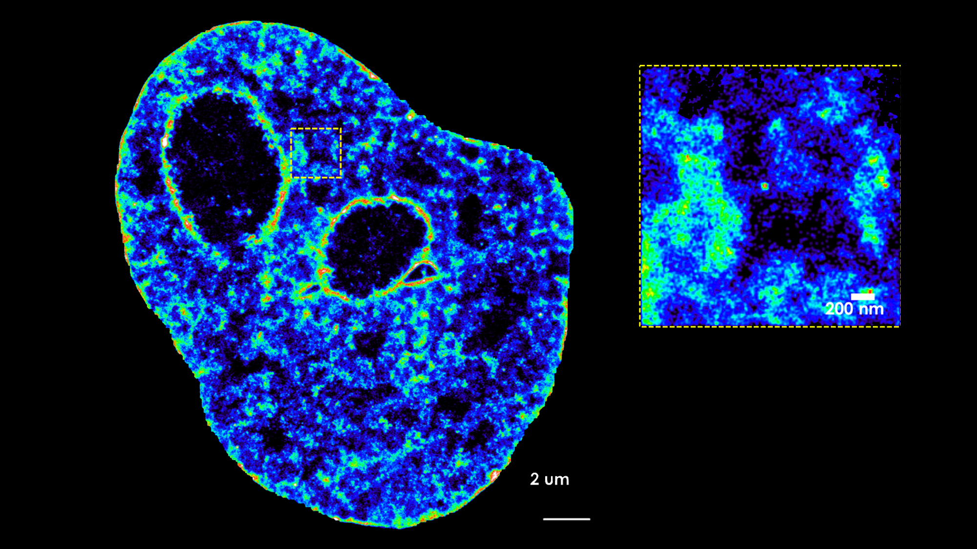 imagen del núcleo de una célula obtenida por microscopía convencional y ampliación de un fragmento hecho con microsocòpia de última generación.
