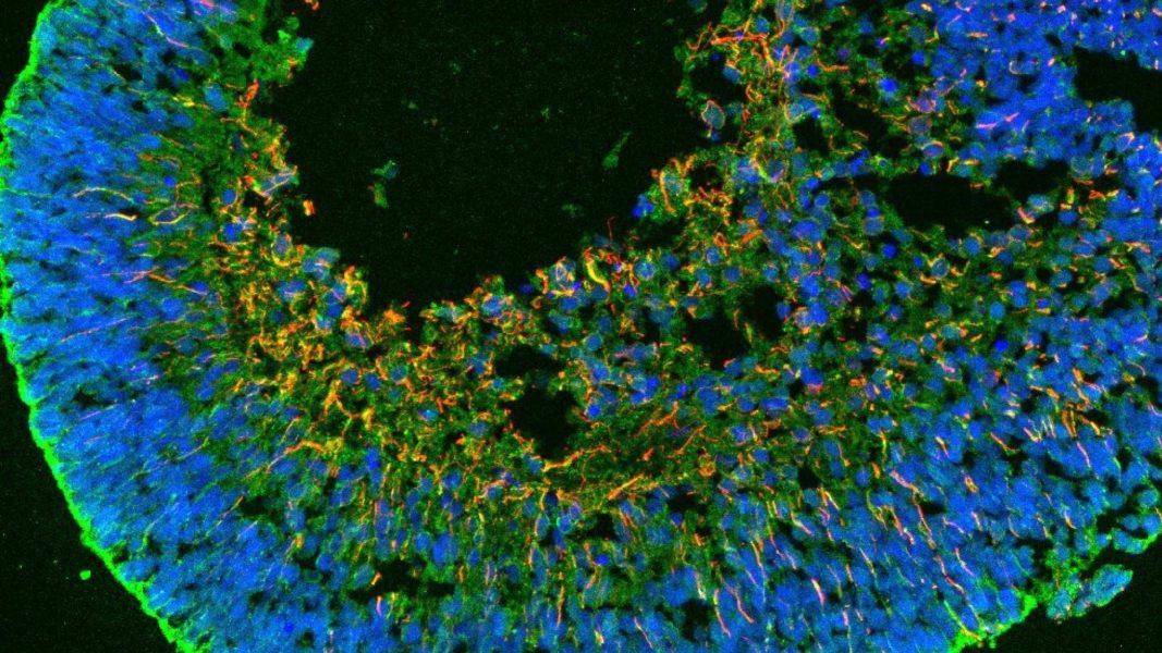 Regenerando nuestra retina El·lipse