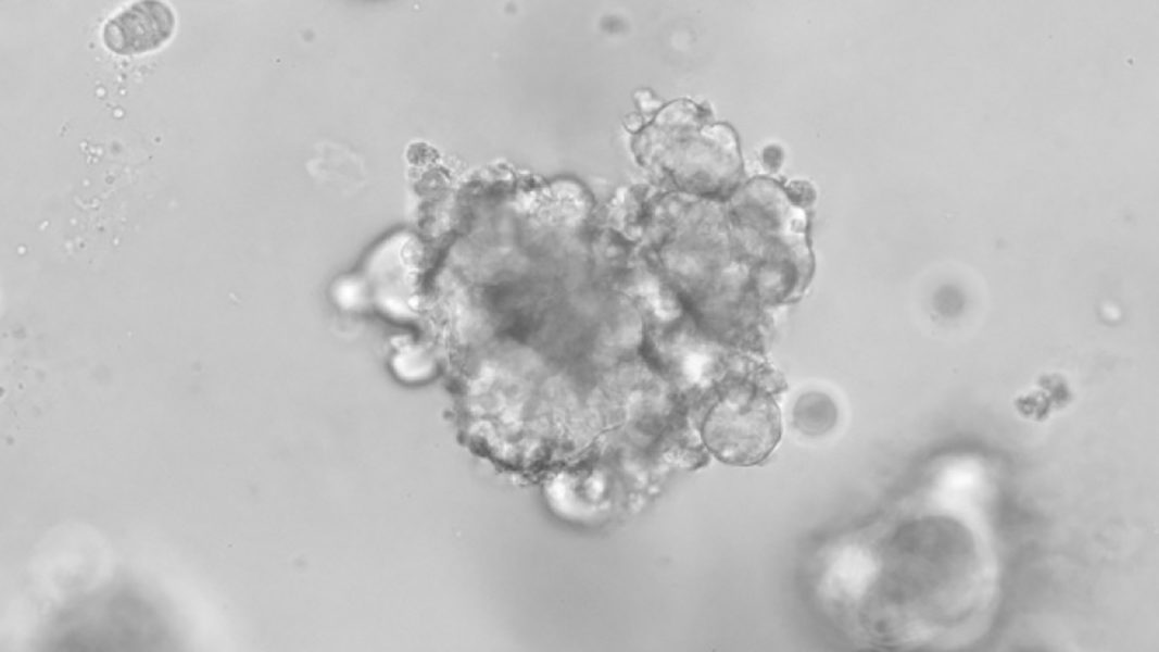 Organoid cultures to understand cancer - El·lipse