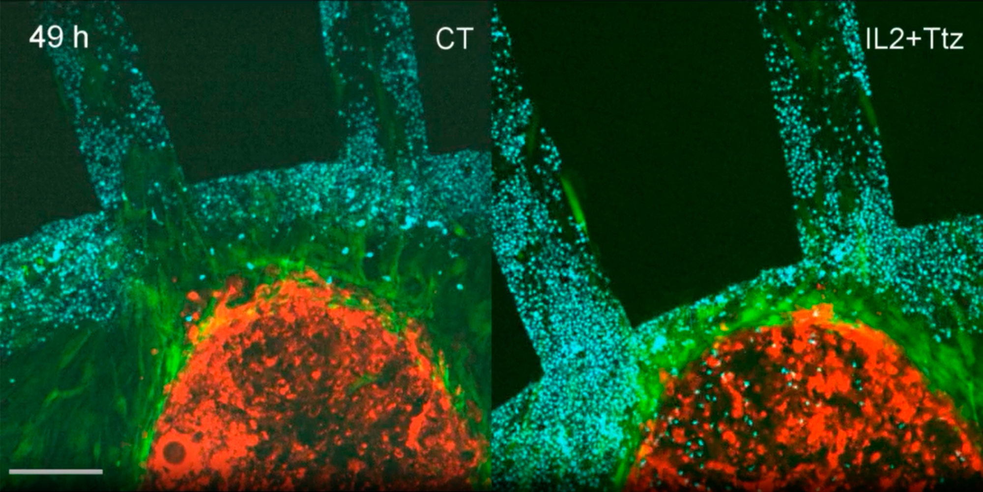 A red mass wrapped in a green mass and a blue one concentrically