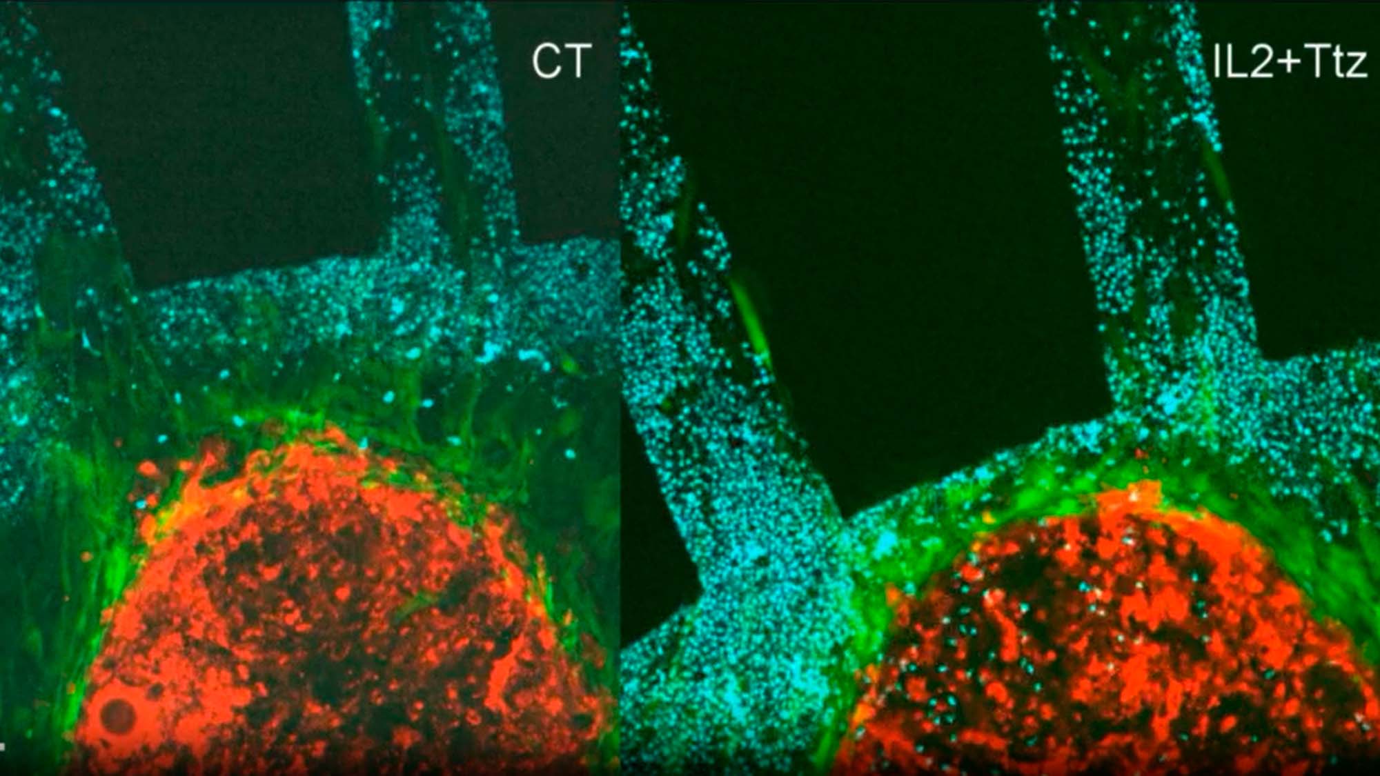 MIRO, a new look at tumour models