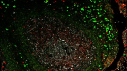 Imagen de microscopía de una sección de tejido de la amígdala con anticuerpos IgD marcados en verde e IgM en rojo.