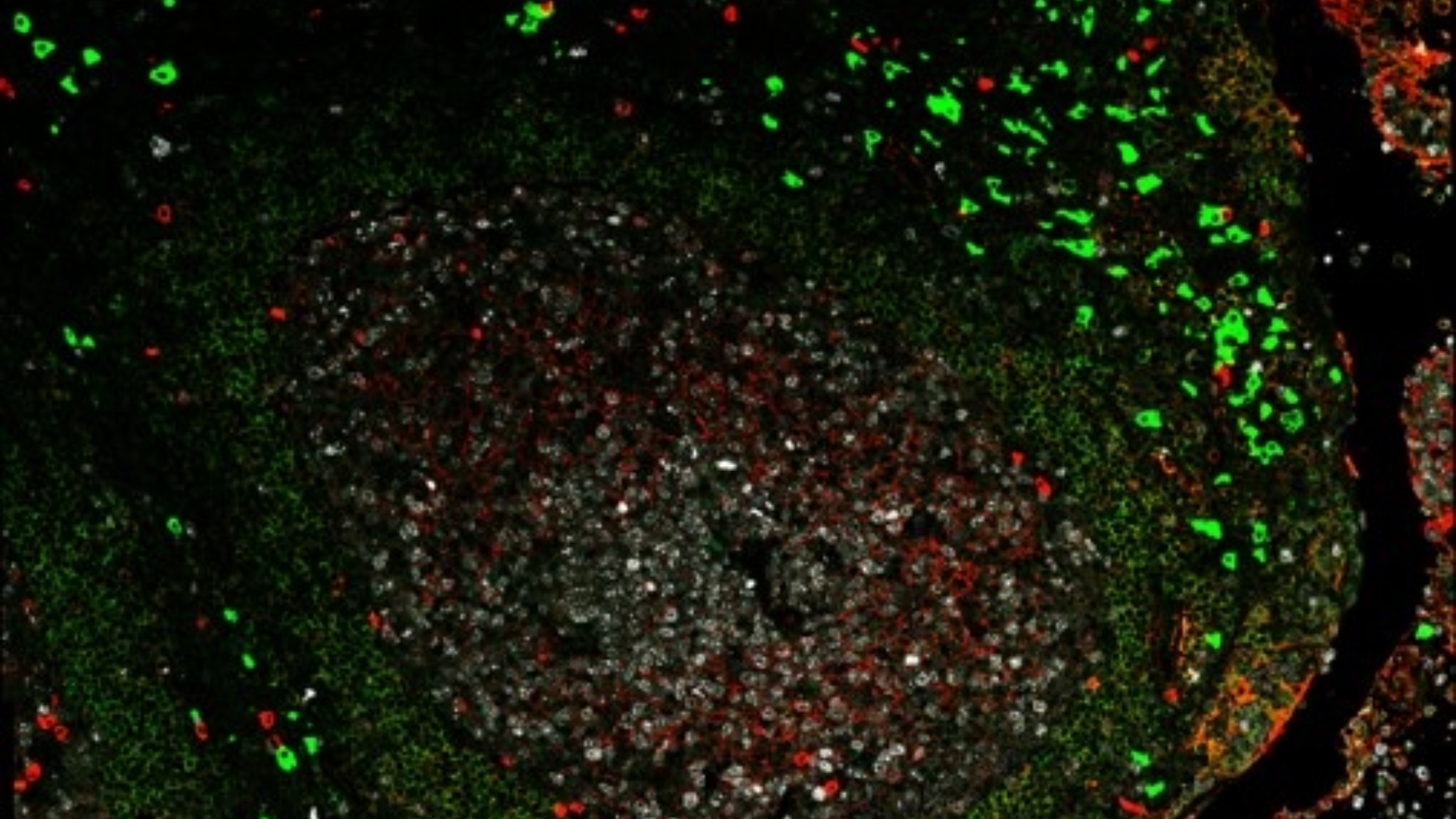 Imagen de microscopía de una sección de tejido de la amígdala con anticuerpos IgD marcados en verde e IgM en rojo.
