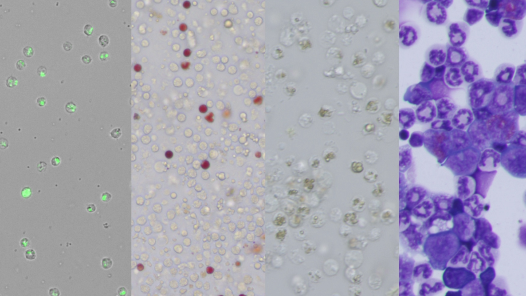 Composite microscopy image showing Capsaspora owczarzaki, sea urchin blood cells, tunicate test cells and mouse bone marrow cells, used to illustrate the evolutionary study of blood-cell lineages.