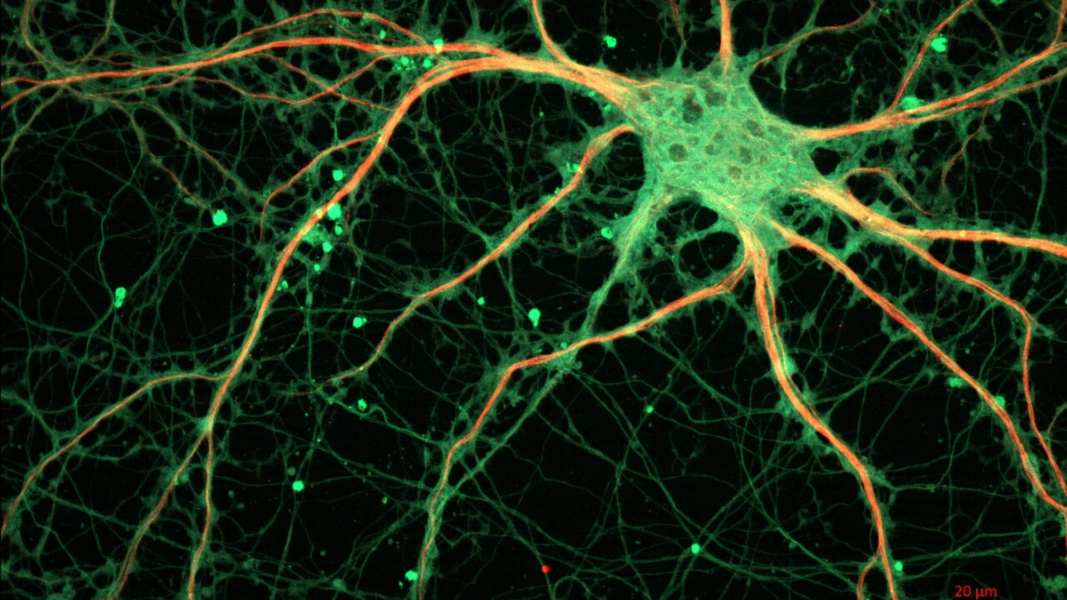 Rat hippocampal neuron viewed under fluorescence microscopy, showing the cell body and its neuronal projections against a dark background.